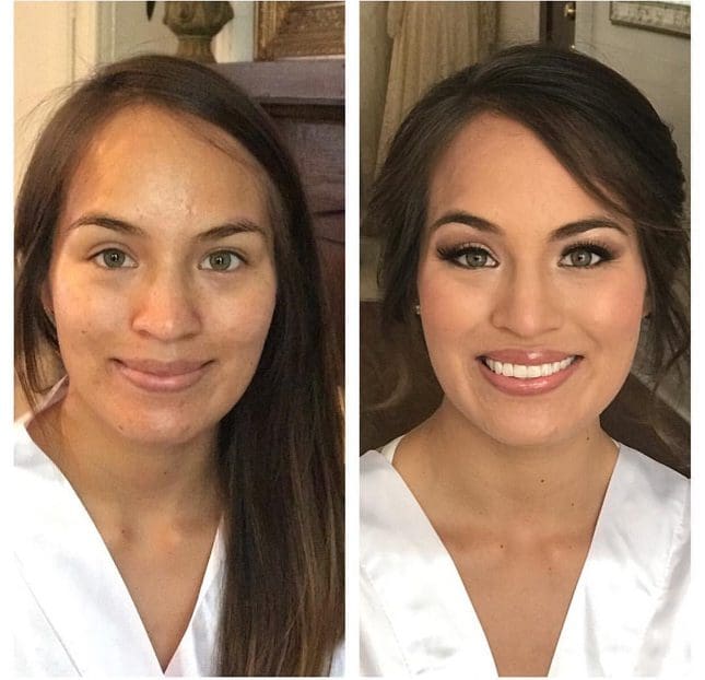 Formal Faces Before and After - Exclusive Gallery Showcase